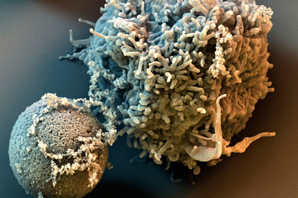 T-cells_22_C1-b